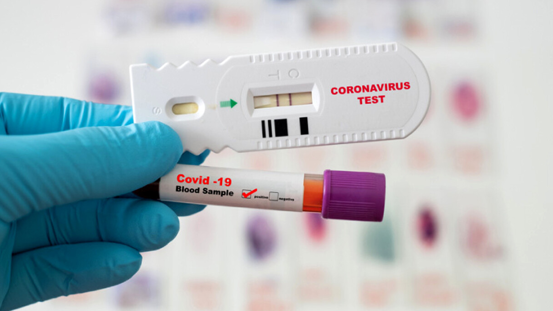 Validazione performance cliniche di un test rapido antigenico